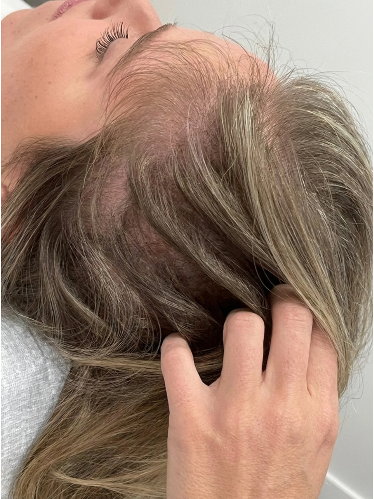 Less Hair Shedding